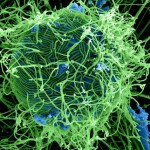Как будет развиваться эпидемия лихорадки Эбола?