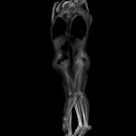 Рентгеновские фото влюблённых — новое слово в искусстве