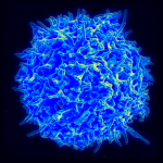 Новое лечение для безнадёжно больных раком — иммунотерапия